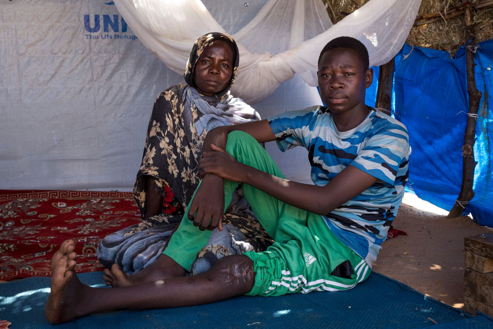 A mother and son sit on the floor of a tent in a refugee camp. The son has one leg out straight and we can see a large scar on his knee.